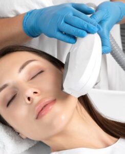 IPL Treatment