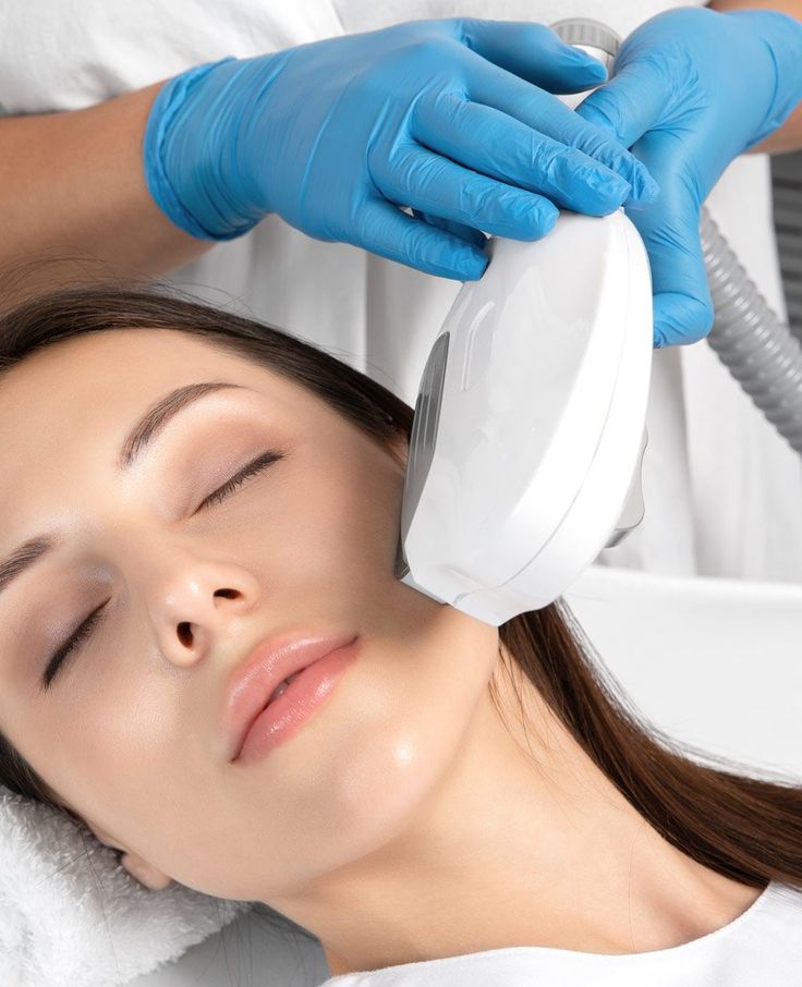 IPL Treatment: Solusi Modern untuk Kulit Cerah dan Bebas Bulu