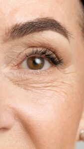 mengenal retinol